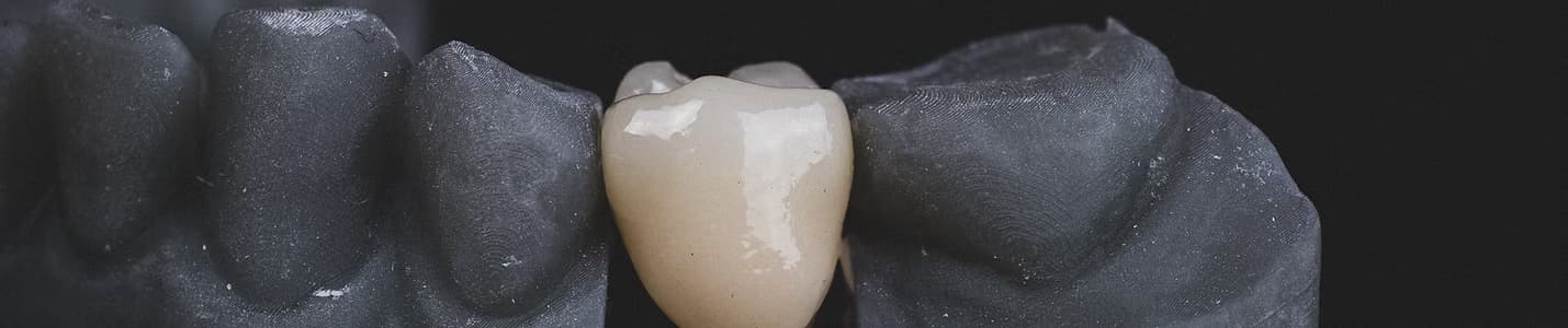 Banner de laboratorio dental de precisión