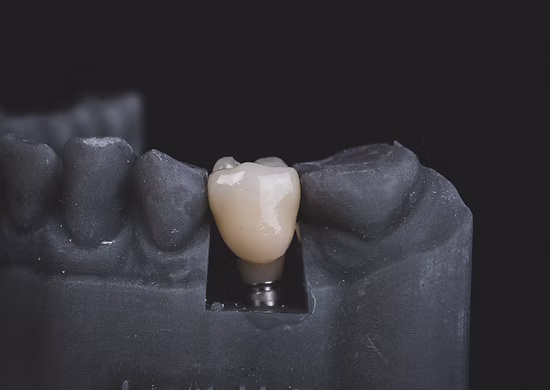 Equipo de Laboratorio Dental