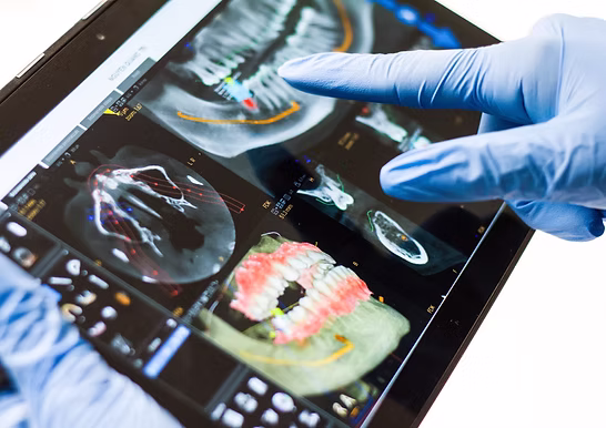 Equipo de Laboratorio Dental